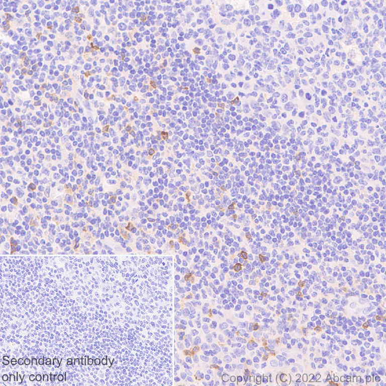 Immunohistochemistry - Anti-APOBEC3G/A3G antibody [EPR25404-59] - BSA and Azide free (AB302927)