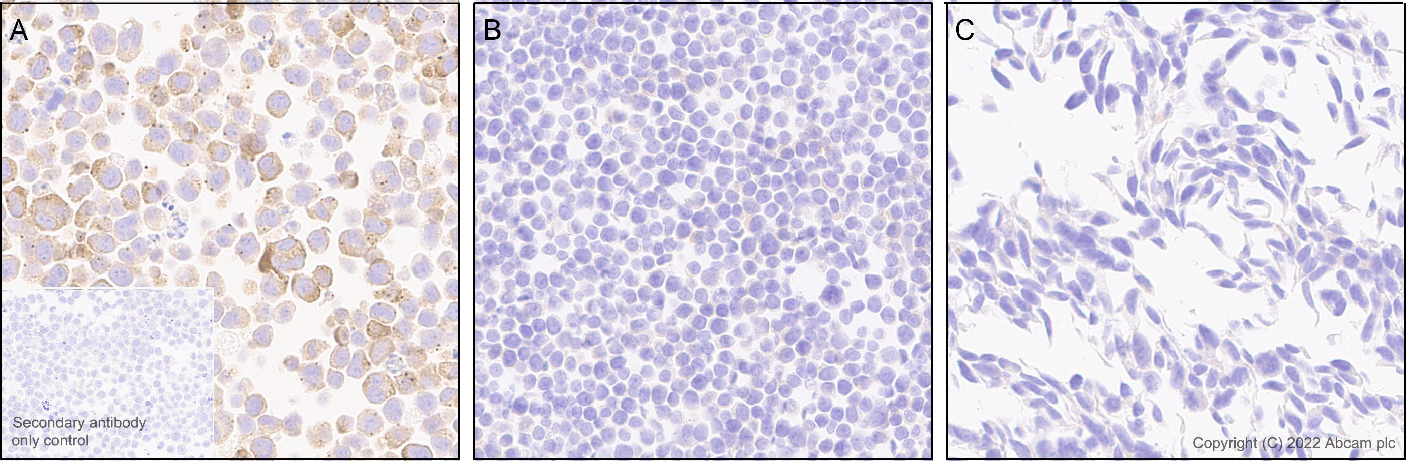 Immunohistochemistry - Anti-APOBEC3G/A3G antibody [EPR25404-59] - BSA and Azide free (AB302927), expandable thumbnail