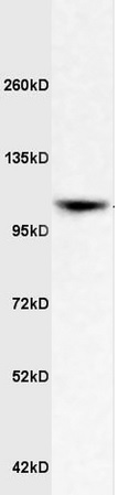Western blot - Anti-ApoER2 antibody (AB204112)