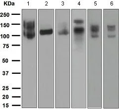 Western blot - Anti-ApoER2 antibody [EPR3326] (AB108208)