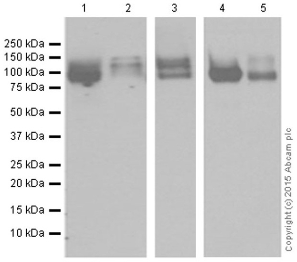 Western blot - Anti-ApoER2 antibody [EPR3326] (AB108208)