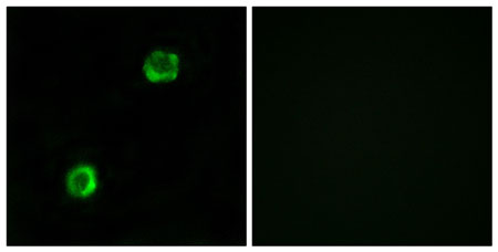 Immunocytochemistry/ Immunofluorescence - Anti-APOL2 antibody (AB196771), expandable thumbnail