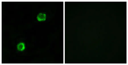Immunocytochemistry/ Immunofluorescence - Anti-APOL2 antibody (AB196771)