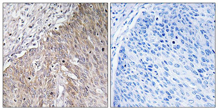 Immunohistochemistry (Formalin/PFA-fixed paraffin-embedded sections) - Anti-APOL2 antibody (AB196771), expandable thumbnail
