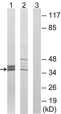 Western blot - Anti-APOL2 antibody (AB196771), expandable thumbnail