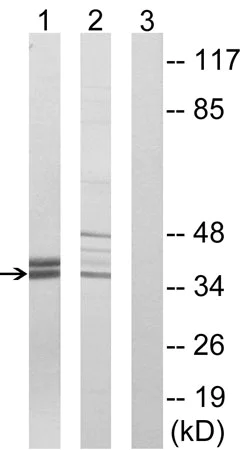 Western blot - Anti-APOL2 antibody (AB196771)