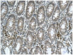 Immunohistochemistry (Formalin/PFA-fixed paraffin-embedded sections) - Anti-APOL3 antibody [EPR8238(2)] (AB154869), expandable thumbnail