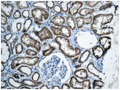 Immunohistochemistry (Formalin/PFA-fixed paraffin-embedded sections) - Anti-APOL3 antibody [EPR8238(2)] (AB154869), expandable thumbnail