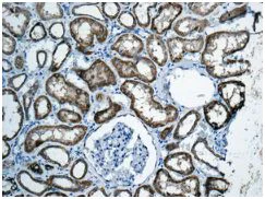 Immunohistochemistry (Formalin/PFA-fixed paraffin-embedded sections) - Anti-APOL3 antibody [EPR8238(2)] - BSA and Azide free (AB249168)