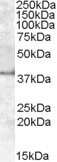 Western blot - Anti-APOL6 antibody (AB92273)