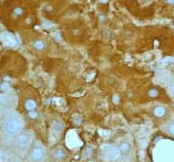 Immunohistochemistry (Formalin/PFA-fixed paraffin-embedded sections) - Anti-Apolipoprotein A I antibody [EP1368Y] - BSA and Azide free (AB271849)