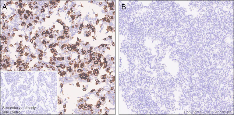 Immunohistochemistry - Anti-Apolipoprotein A I antibody [EPR25446-111] (AB307089)