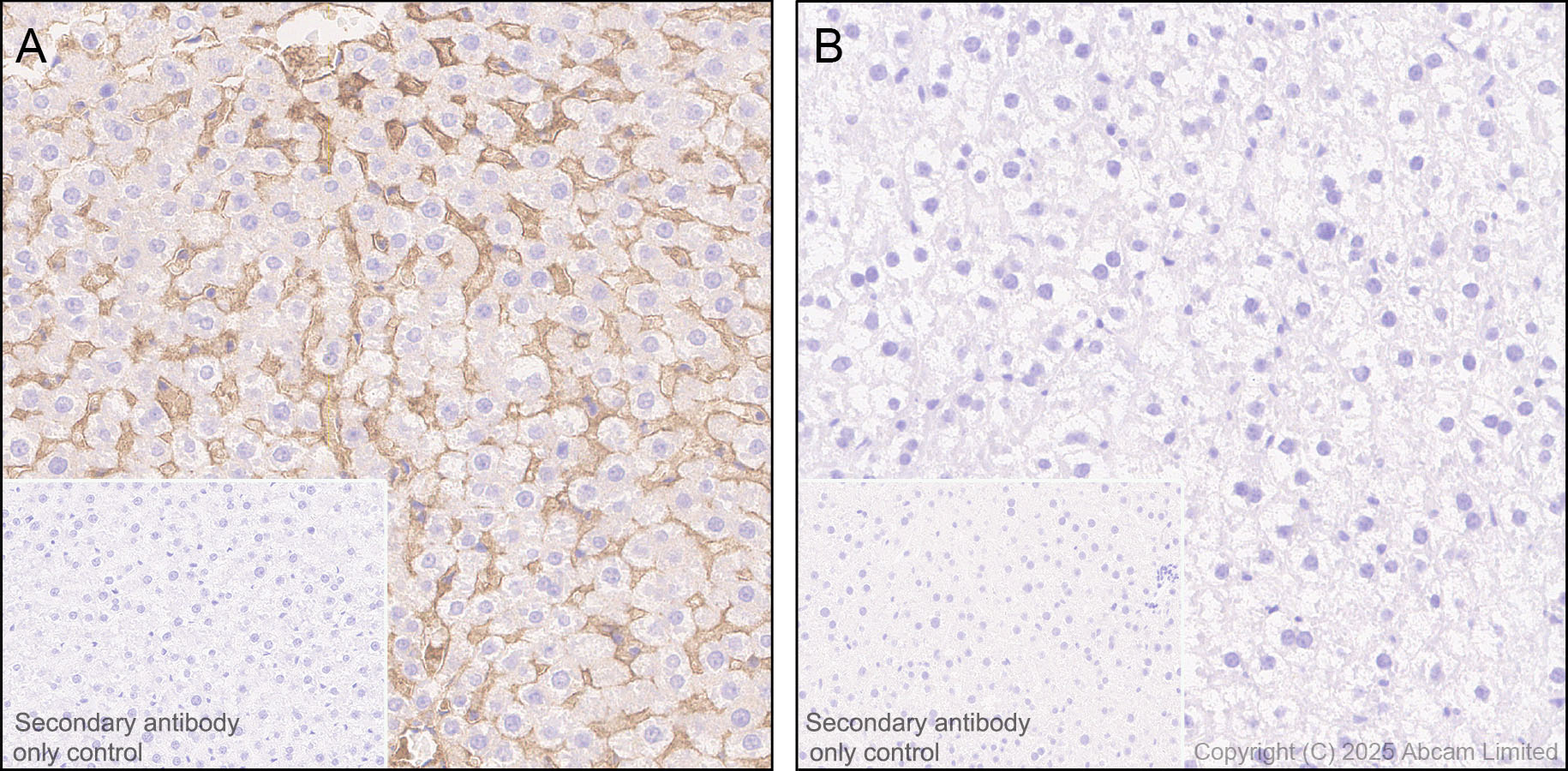 Immunohistochemistry (Formalin/PFA-fixed paraffin-embedded sections) - Anti-Apolipoprotein A I antibody [EPR28749-505] (AB323863), expandable thumbnail