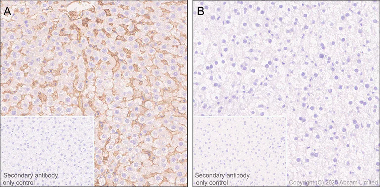 Immunohistochemistry (Formalin/PFA-fixed paraffin-embedded sections) - Anti-Apolipoprotein A I antibody [EPR28749-505] (AB323863)