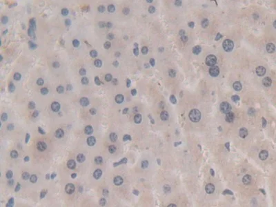 Immunohistochemistry (Formalin/PFA-fixed paraffin-embedded sections) - Anti-Apolipoprotein A V/APOA5 antibody [C6] (AB239579)