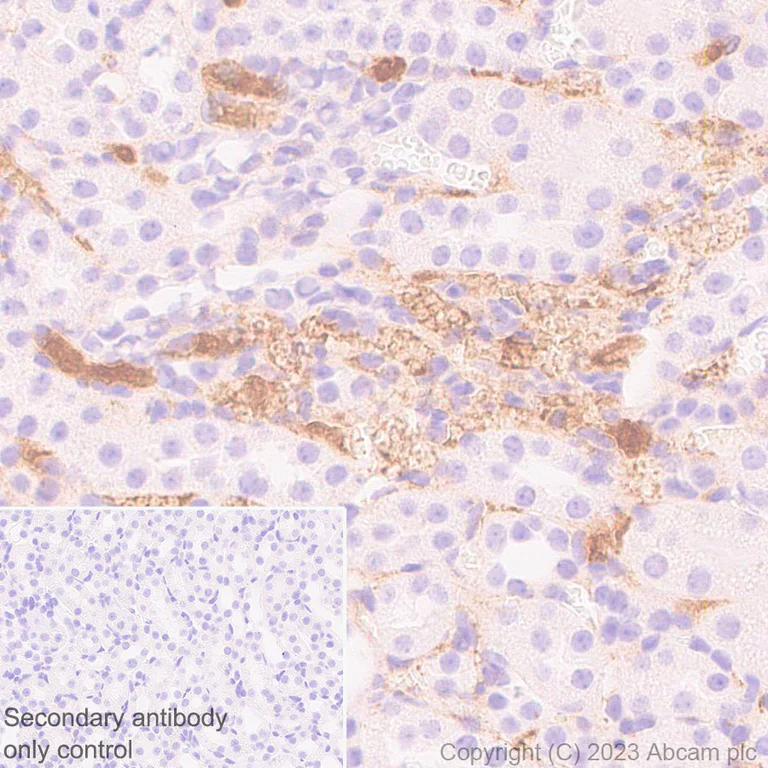 Immunohistochemistry (Formalin/PFA-fixed paraffin-embedded sections) - Anti-Apolipoprotein B-100 antibody [EPR19946-175] (AB315265)