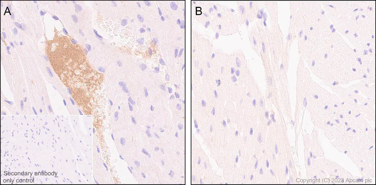 Immunohistochemistry (Formalin/PFA-fixed paraffin-embedded sections) - Anti-Apolipoprotein B-100 antibody [EPR19946-175] (AB315265)