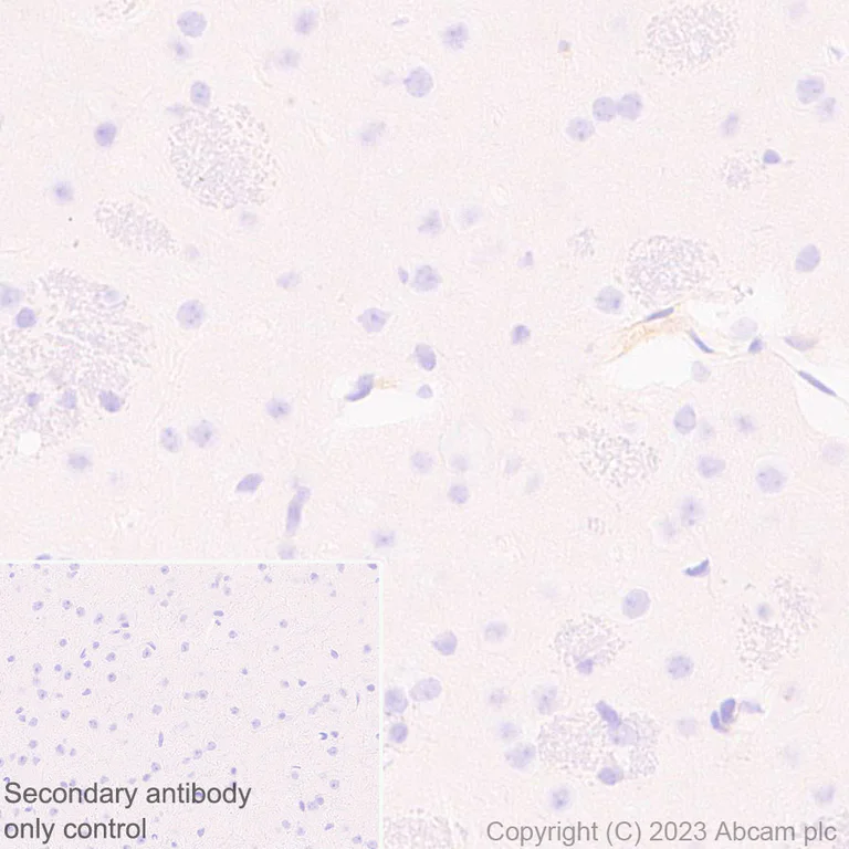 Immunohistochemistry (Formalin/PFA-fixed paraffin-embedded sections) - Anti-Apolipoprotein B-100 antibody [EPR19946-175] (AB315265)