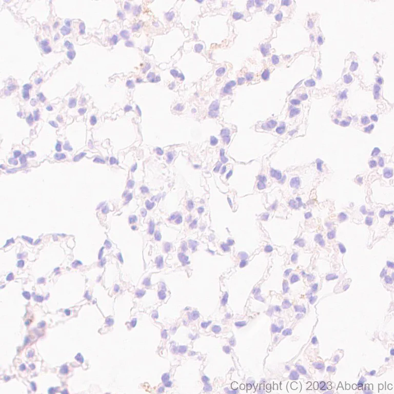 Immunohistochemistry (Formalin/PFA-fixed paraffin-embedded sections) - Anti-Apolipoprotein B-100 antibody [EPR19946-175] (AB315265)