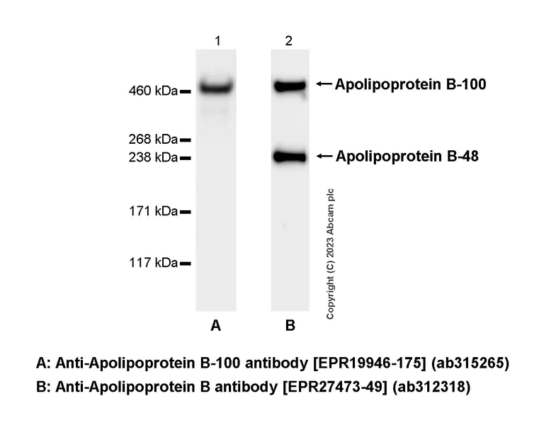 Western blot - Anti-Apolipoprotein B-100 antibody [EPR19946-175] (AB315265)