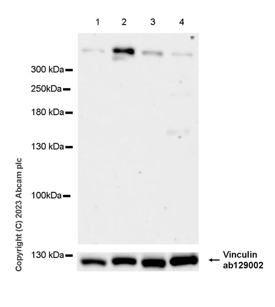 Western blot - Anti-Apolipoprotein B-100 antibody [EPR19946-175] (AB315265)
