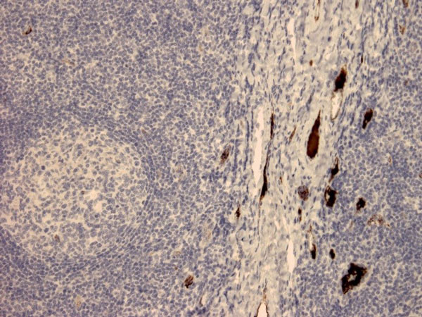 Immunohistochemistry (Formalin/PFA-fixed paraffin-embedded sections) - Anti-Apolipoprotein B antibody [7B8] (AB39560)