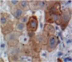 Immunohistochemistry (Formalin/PFA-fixed paraffin-embedded sections) - Anti-Apolipoprotein B antibody (AB231574)