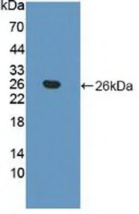 Western blot - Anti-Apolipoprotein B antibody (AB231574)