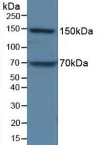 Western blot - Anti-Apolipoprotein B antibody (AB231574)