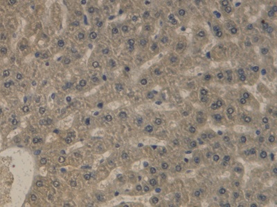 Immunohistochemistry (Formalin/PFA-fixed paraffin-embedded sections) - Anti-Apolipoprotein B antibody [C3] (AB239581)