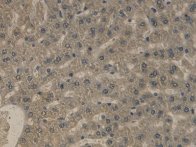 Immunohistochemistry (Formalin/PFA-fixed paraffin-embedded sections) - Anti-Apolipoprotein B antibody [C3] (AB239581)
