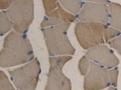 Immunohistochemistry (Formalin/PFA-fixed paraffin-embedded sections) - Anti-Apolipoprotein B antibody [C3] (AB239581)