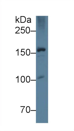 Western blot - Anti-Apolipoprotein B antibody [C3] (AB239581)
