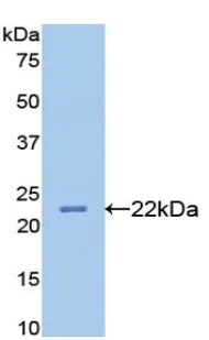 Western blot - Anti-Apolipoprotein B antibody [C3] (AB239581)