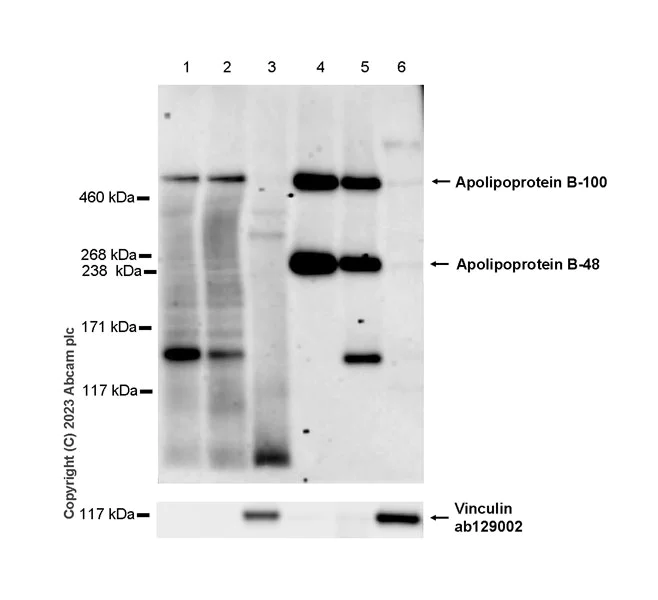 Western blot - Anti-Apolipoprotein B antibody [EPR27473-49] - BSA and Azide free (AB312319)