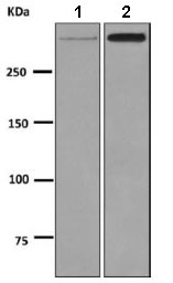 Western blot - Anti-Apolipoprotein B antibody [EPR2914] - BSA and Azide free (AB231683)