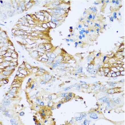 Immunohistochemistry (Formalin/PFA-fixed paraffin-embedded sections) - Anti-Apolipoprotein CI/Apo-CI antibody (AB189866)