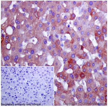 Immunohistochemistry (Formalin/PFA-fixed paraffin-embedded sections) - Anti-Apolipoprotein CI/Apo-CI antibody [EPR16813] (AB198288)