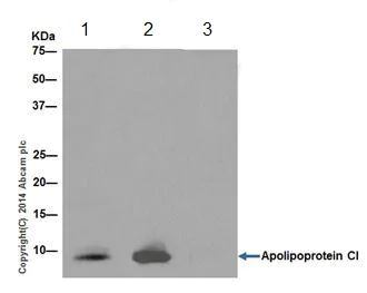 Immunoprecipitation - Anti-Apolipoprotein CI/Apo-CI antibody [EPR16813] (AB198288)