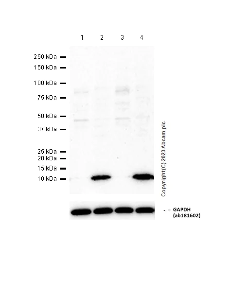 Western blot - Anti-Apolipoprotein CI/Apo-CI antibody [EPR16813] (AB198288)