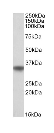 Western blot - Anti-Apolipoprotein E antibody (AB32897)