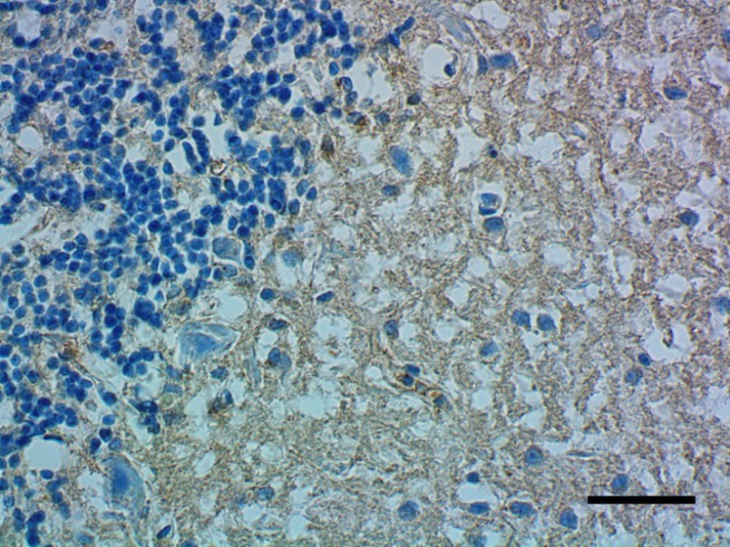 Immunohistochemistry (Formalin/PFA-fixed paraffin-embedded sections) - Anti-Apolipoprotein E antibody [D6E10] - BSA and Azide free (AB1906)