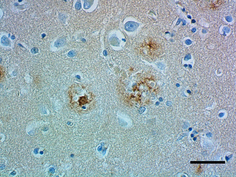 Immunohistochemistry (Formalin/PFA-fixed paraffin-embedded sections) - Anti-Apolipoprotein E antibody [D6E10] - BSA and Azide free (AB1906)