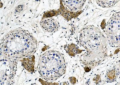 Immunohistochemistry (Formalin/PFA-fixed paraffin-embedded sections) - Anti-Apolipoprotein E antibody [D6E10] - BSA and Azide free (AB1906)