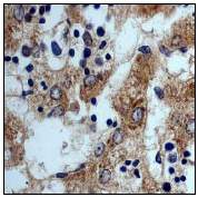 Immunohistochemistry (Formalin/PFA-fixed paraffin-embedded sections) - Anti-Apolipoprotein E antibody [EP1373Y] (AB51015), expandable thumbnail