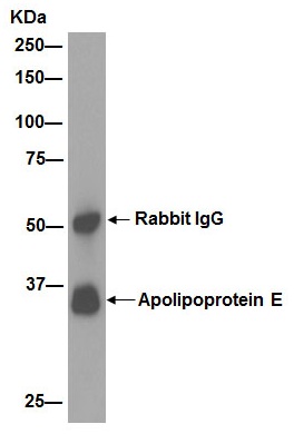 Immunoprecipitation - Anti-Apolipoprotein E antibody [EP1373Y] (AB51015), expandable thumbnail
