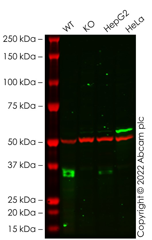 Western blot - Anti-Apolipoprotein E antibody [EP1373Y] (ab51015), expandable thumbnail