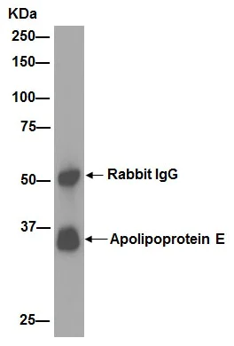 Immunoprecipitation - Anti-Apolipoprotein E antibody [EP1373Y] - BSA and Azide free (AB171357)