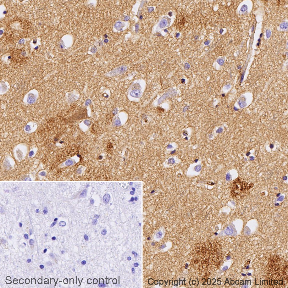 Anti-Apolipoprotein E antibody [EP1374Y]