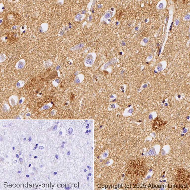 Immunohistochemistry (Formalin/PFA-fixed paraffin-embedded sections) - Anti-Apolipoprotein E antibody [EP1374Y] (AB52607)